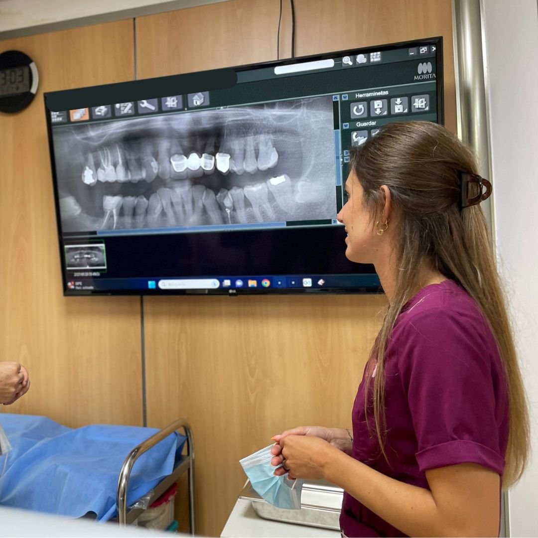 Estudio individual del caso con radiografía dental